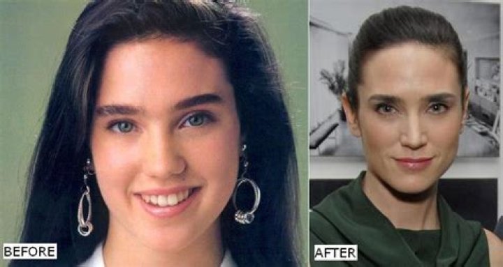 Unveiling The Truth Behind Jennifer Connelly's Plastic Surgery Rumors